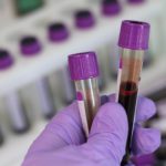 Coronavirus quel est la situation en Guadeloupe (1)